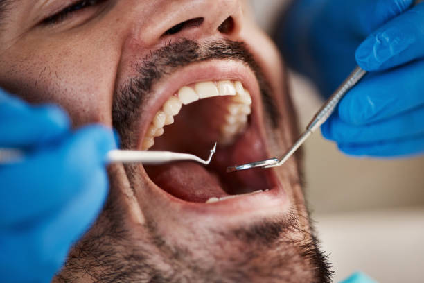 Best Mobile Emergency Dentist in Paramount Long Meadow, MD