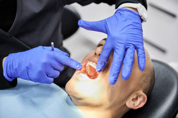 Best Emergency Dentist for Lost Fillings or Crowns in Paramount Long Meadow, MD